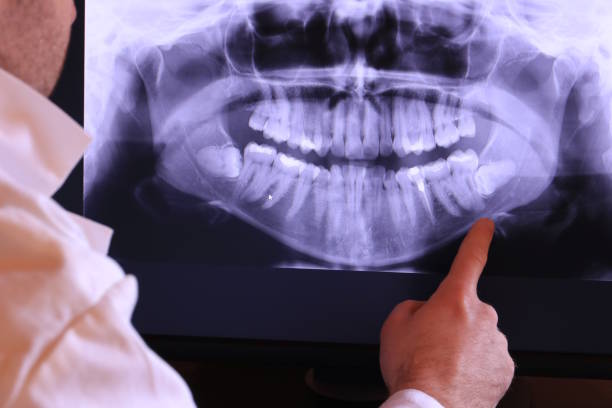 Best After-Hours Dental Trauma Care in Airport, CA