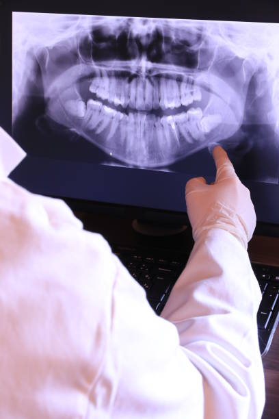 Best Emergency Treatment for Dental Infections or Abscesses in Airport, CA