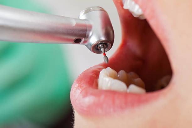  Airport, CA Emergency Dentist Pros
